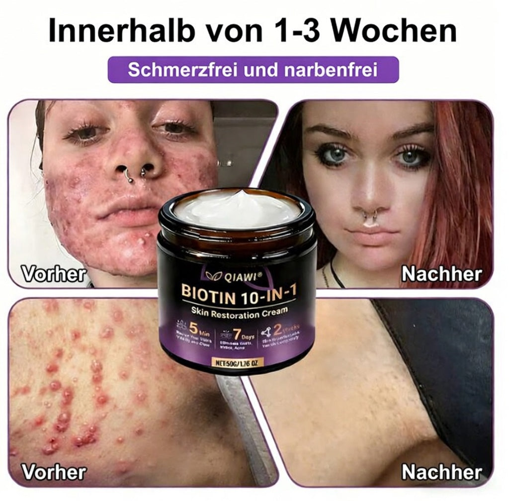 Hergestellt und versendet aus den USA ✨ QIAWI® Biotin 10-in-1 Skin Restoration Cream 🍀-H1