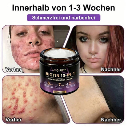 Hergestellt und versendet aus den USA ✨ QIAWI® Biotin 10-in-1 Skin Restoration Cream 🍀-H1