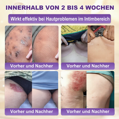 Hergestellt und versendet aus den USA ✨ QIAWI® Biotin 10-in-1 Skin Restoration Cream 🍀-H1