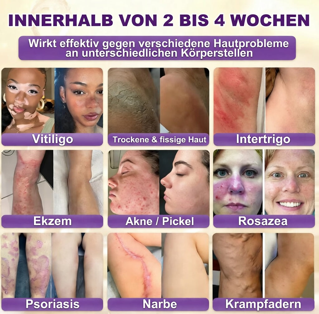 Hergestellt und versendet aus den USA ✨ QIAWI® Biotin 10-in-1 Skin Restoration Cream 🍀-H1