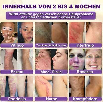 Hergestellt und versendet aus den USA ✨ QIAWI® Biotin 10-in-1 Skin Restoration Cream 🍀-H1