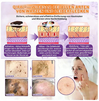 Hergestellt und versendet aus den USA ✨ QIAWI® Biotin 10-in-1 Skin Restoration Cream 🍀-H1